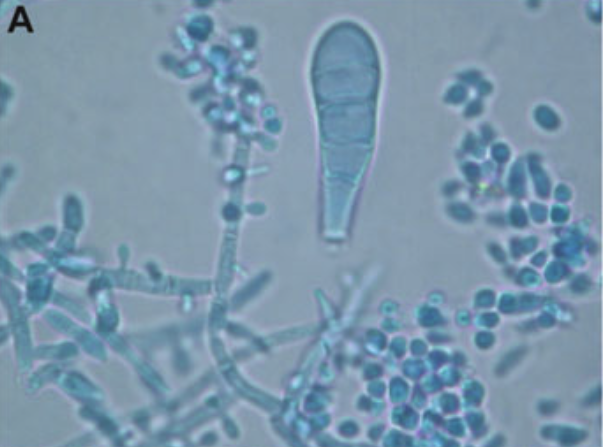 Microscopic image of Trichophyton Mentagrophytes